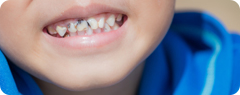Dentist Columbia SC