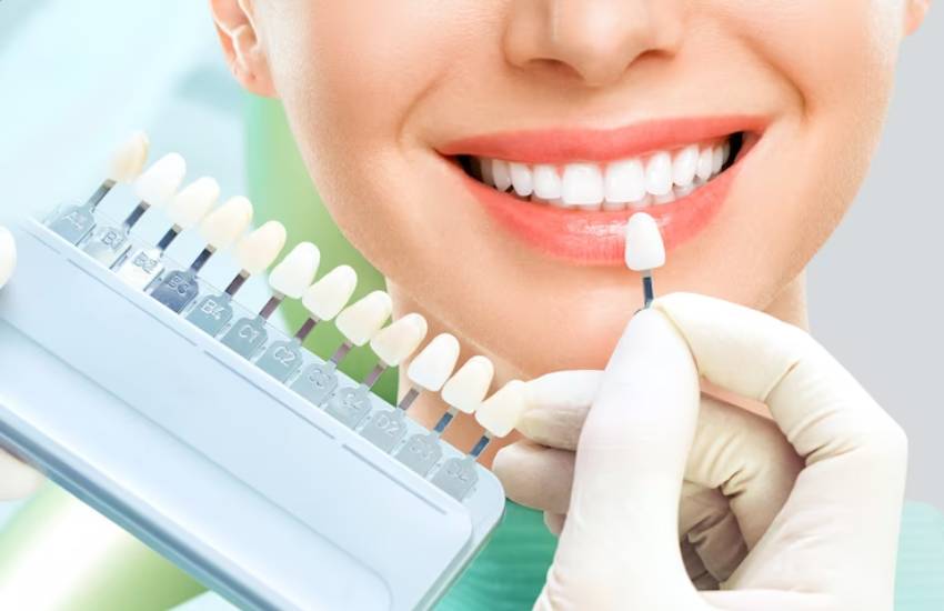 teeth whitening bleach